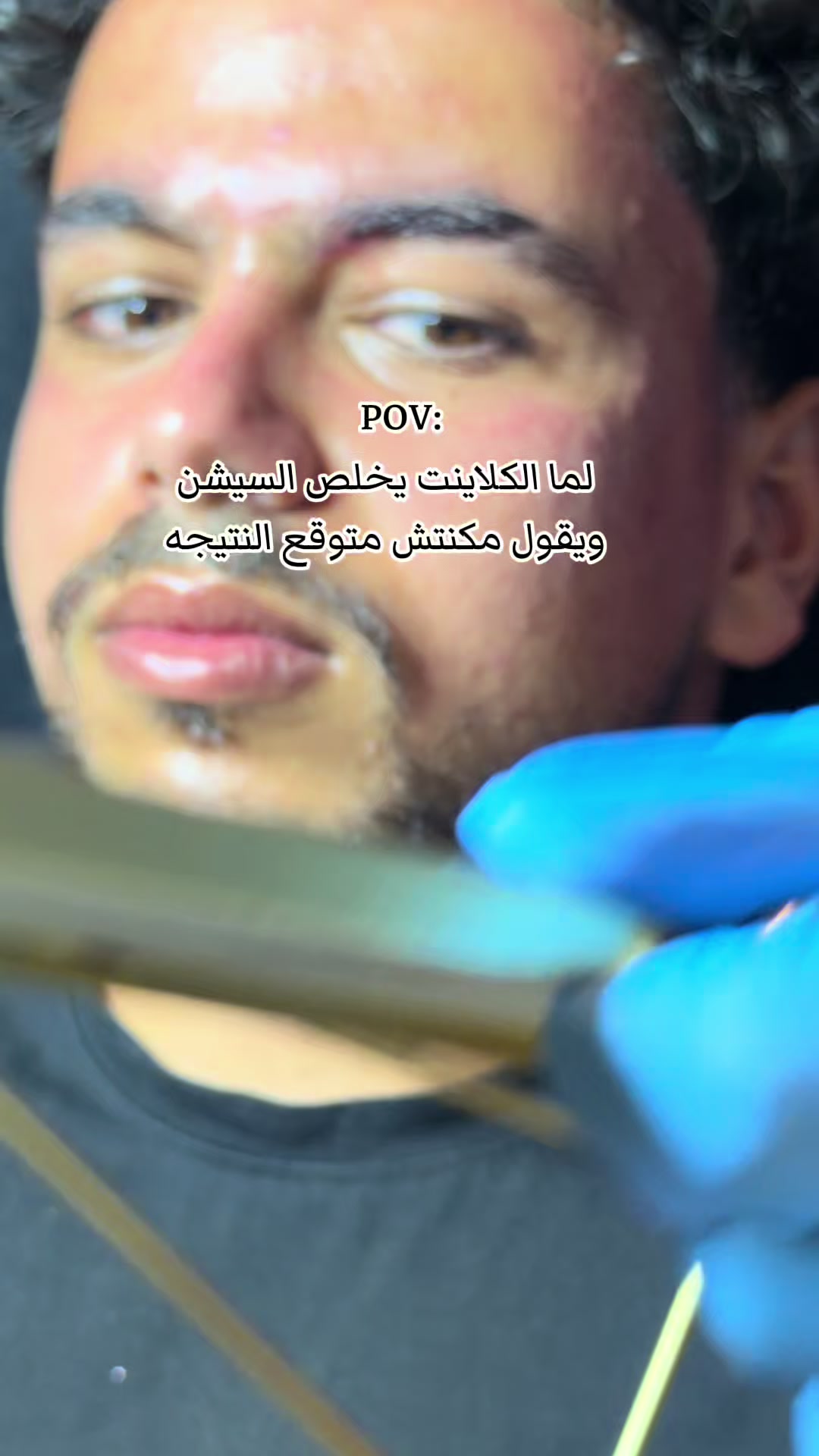 @menna_skintherapist