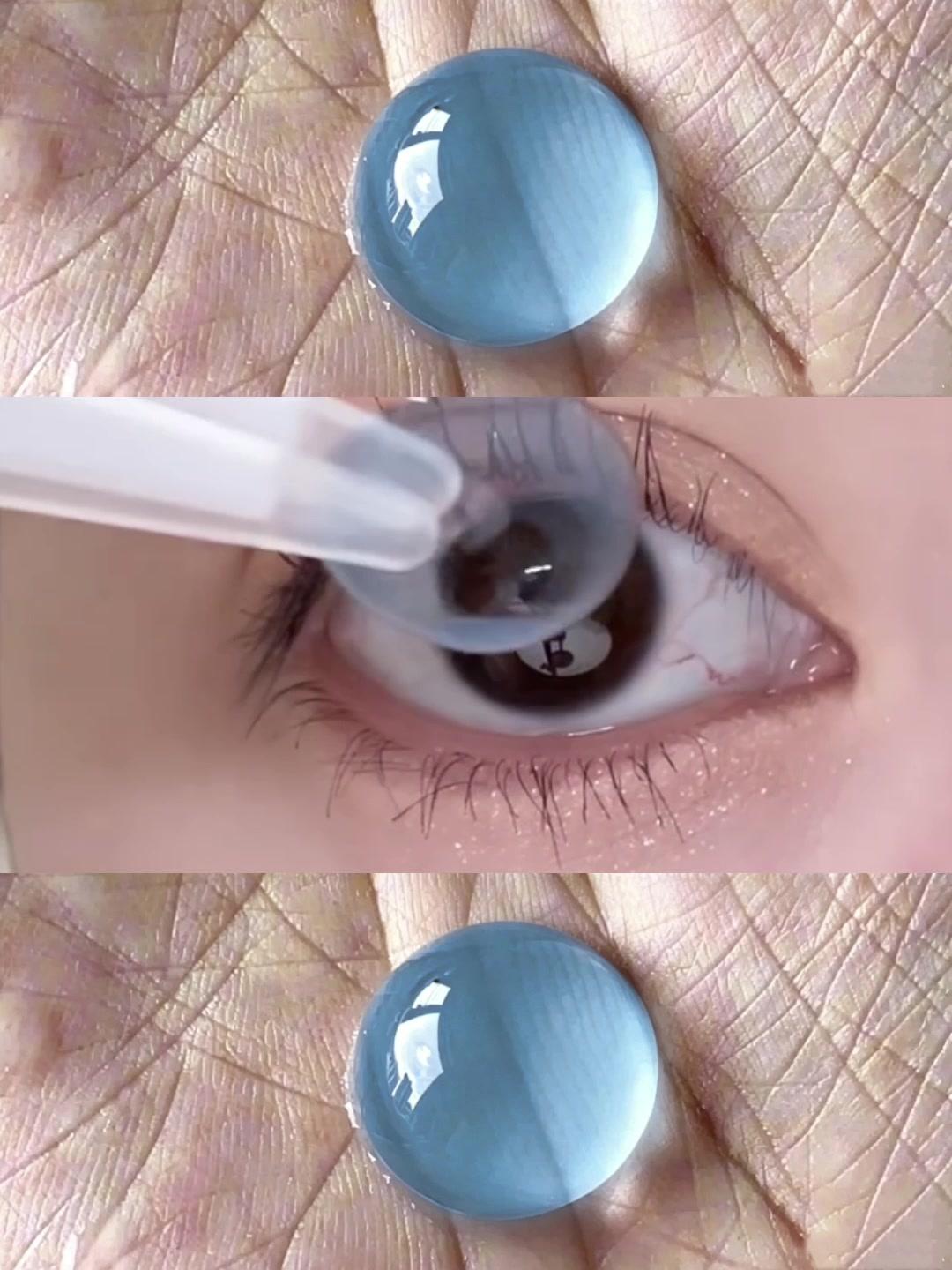 @4YOU Contact Lens