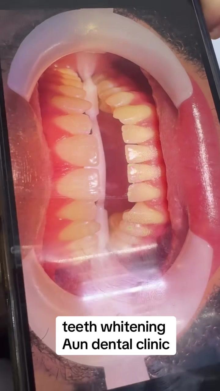 @Aun dental clinic ❤️