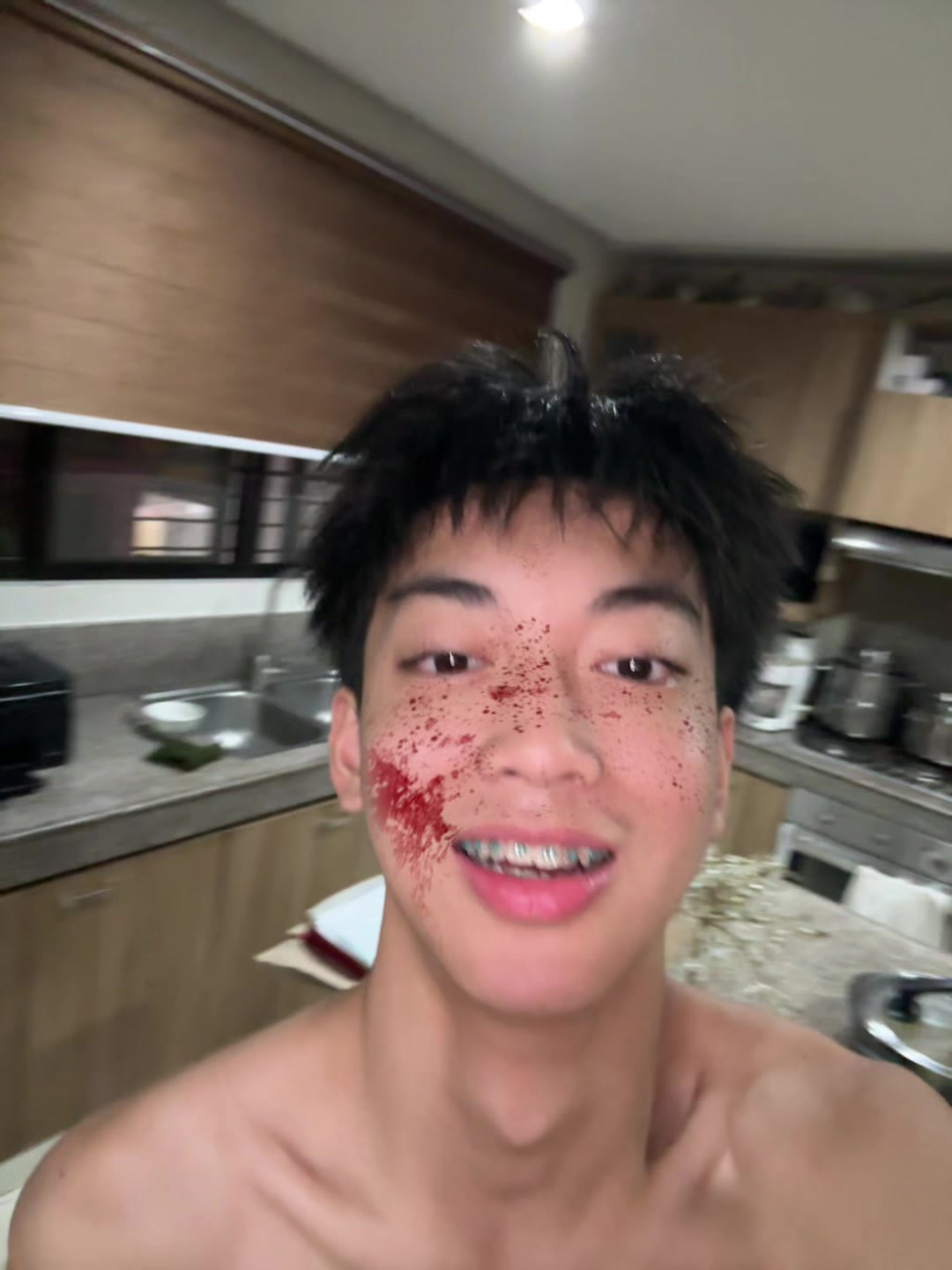@ten