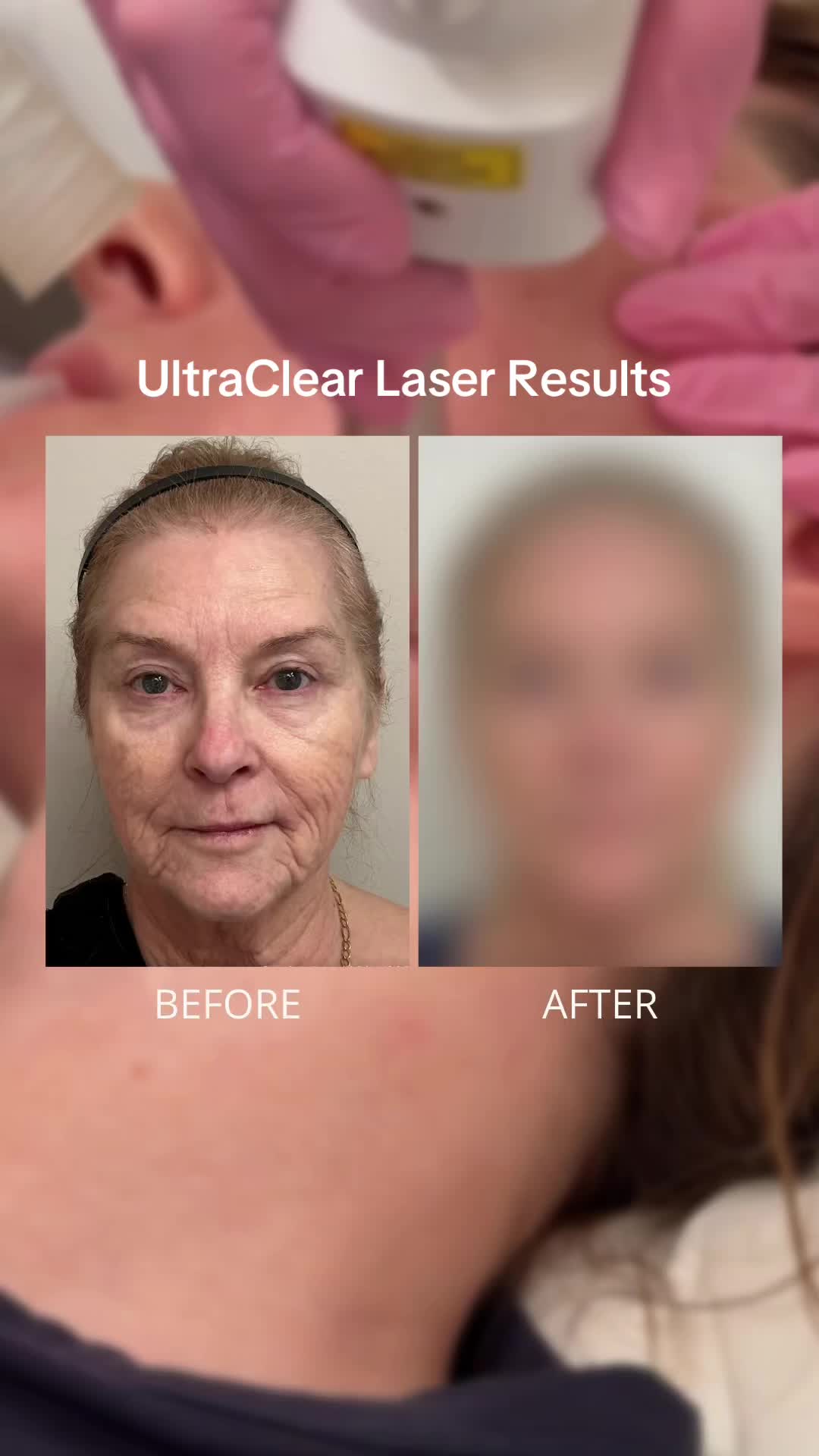@Mona Dermatology | Cincinnati