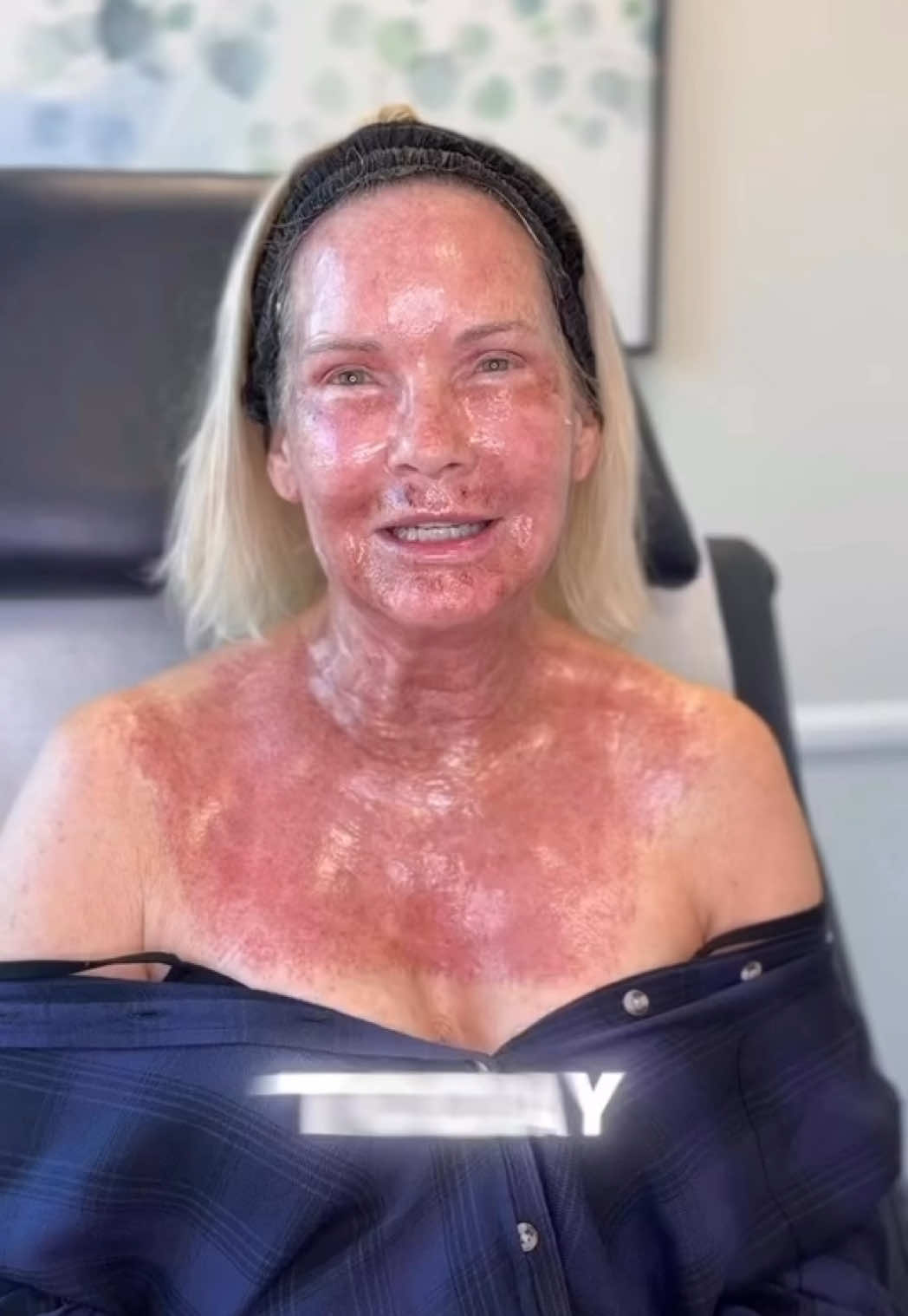 @AdvancedDermatology661