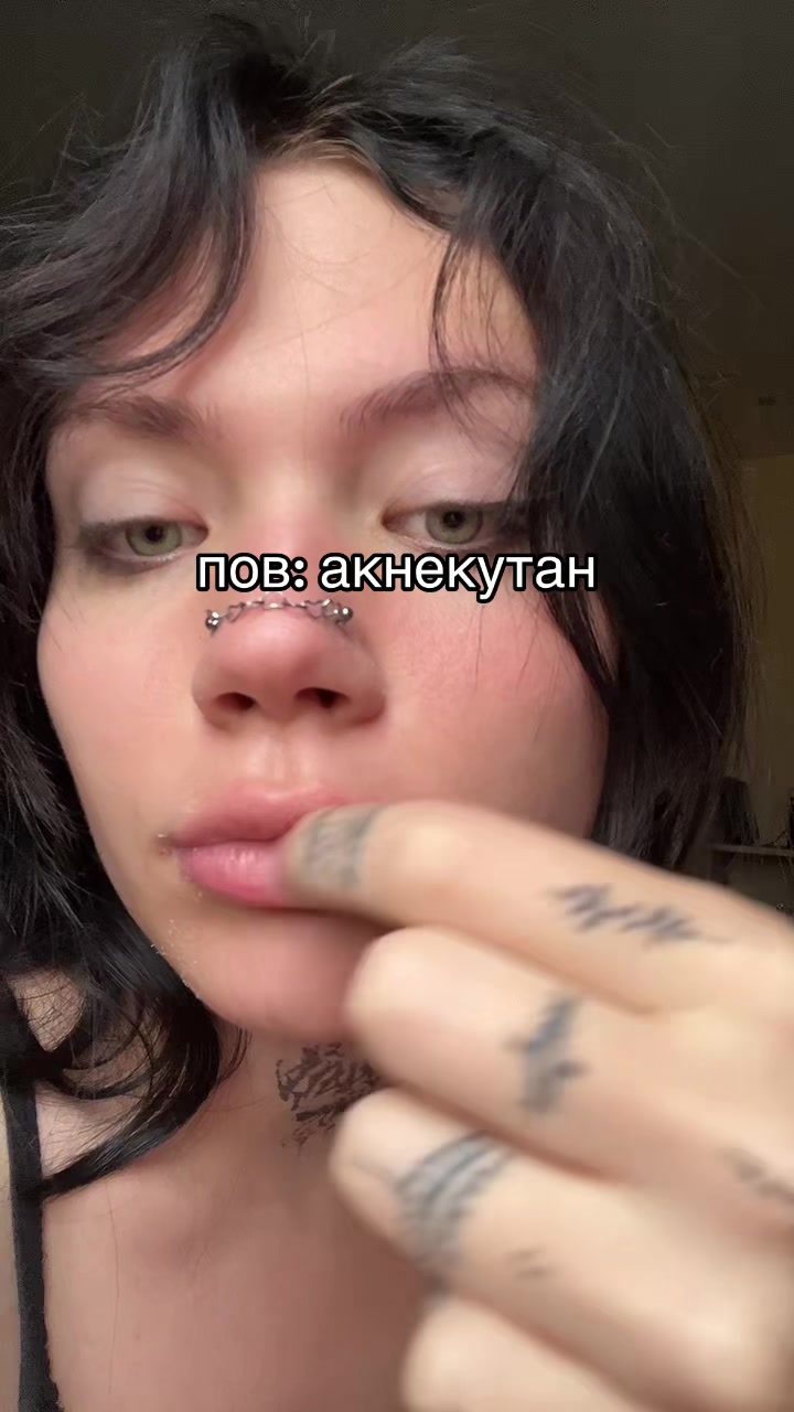 @aggonniia
