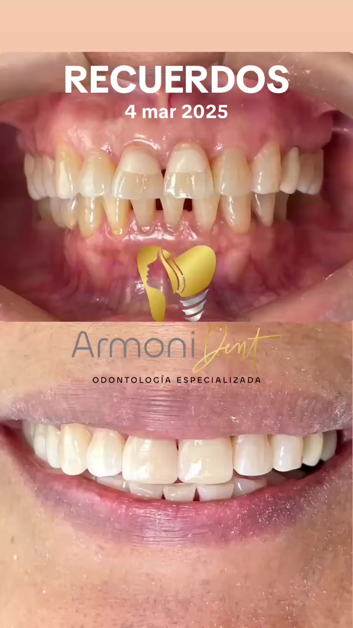 @ARMONI DENT