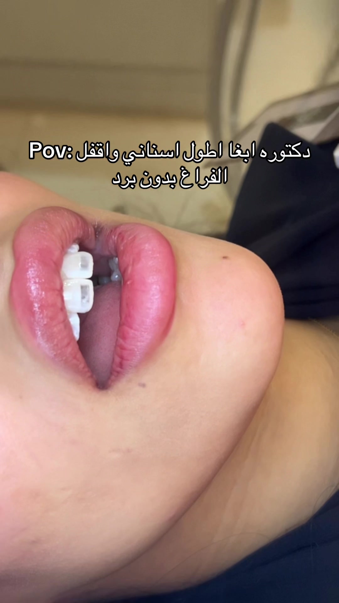 @Dr. Abrar Alhababi