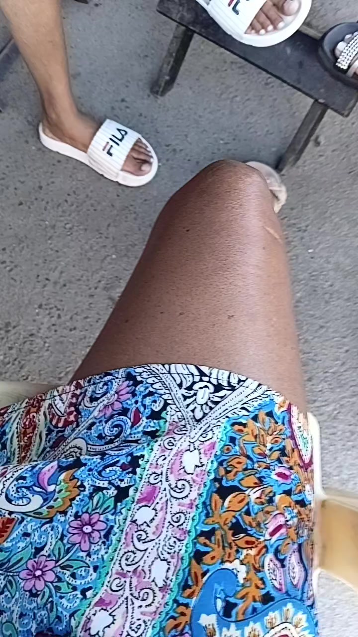 @vanuza amputada 🥰🦵👨&zwj;🦽👑
