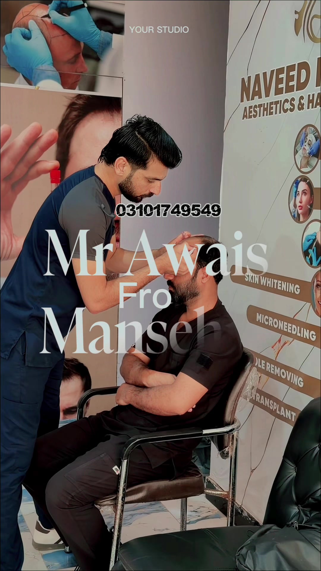 @Naveed Marwat HairTrnsplant