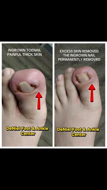 @Deniel Foot and Ankle Center