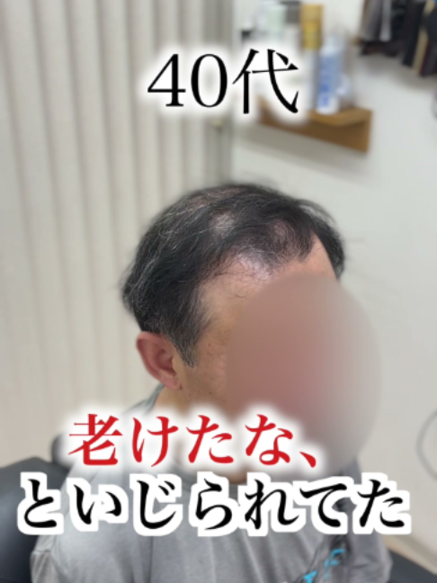 @even | 広島のオーダーウィッグ専門店
