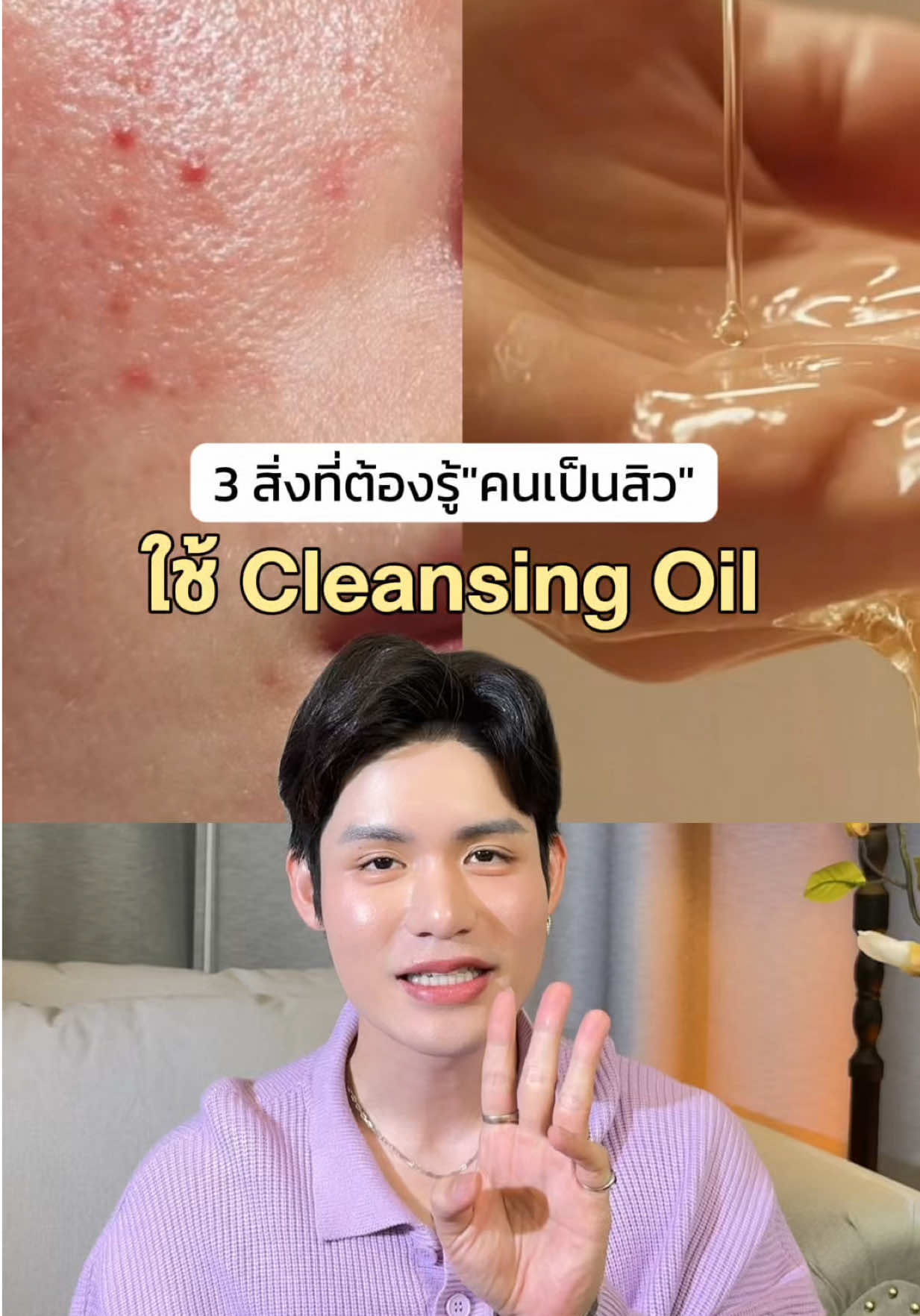 @หนูปอนด์ที่ชอบเลเซ่อร์