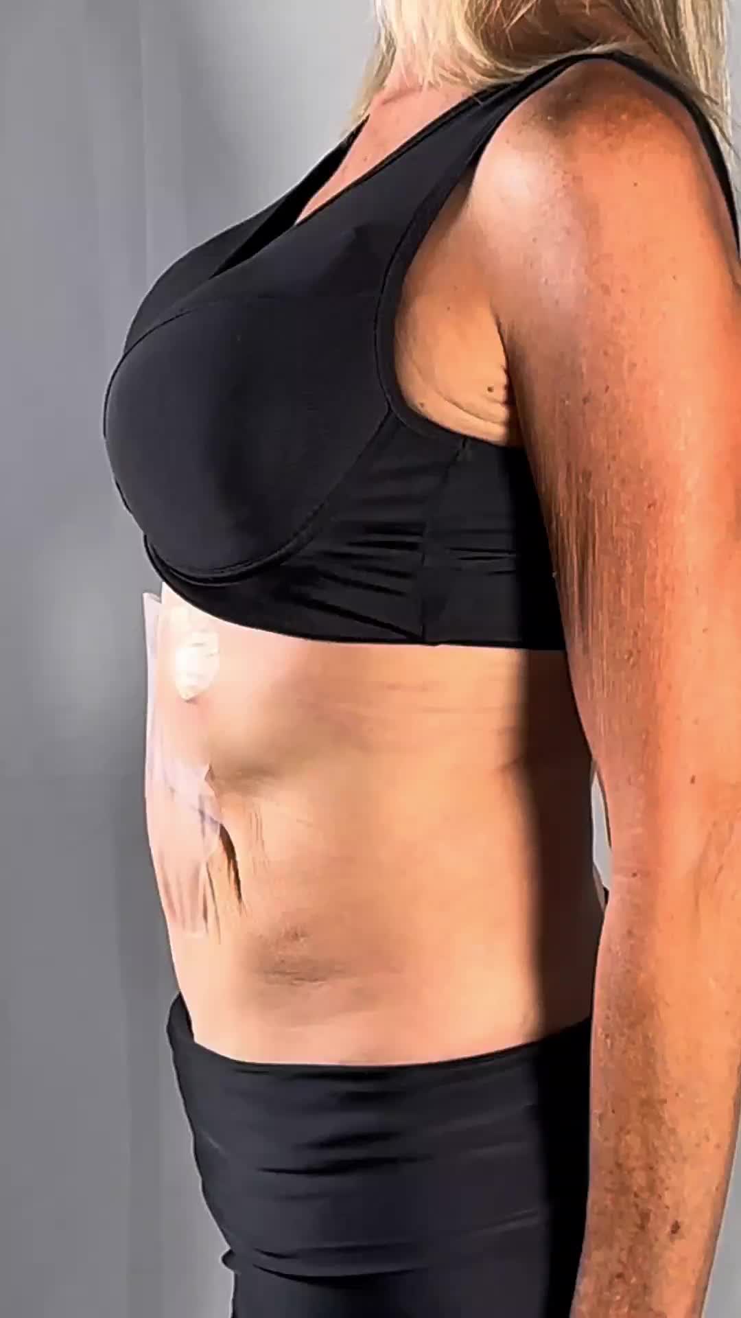 @Skinnies InstantLifts