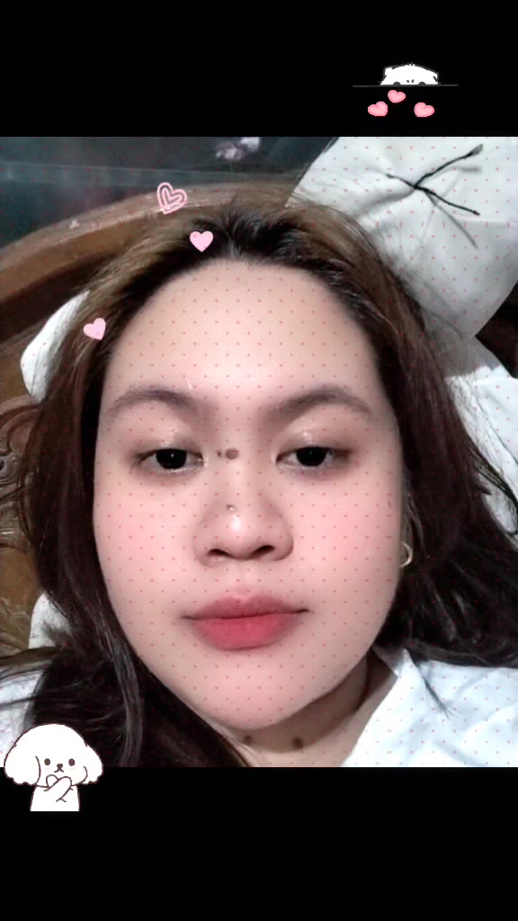@Kyla