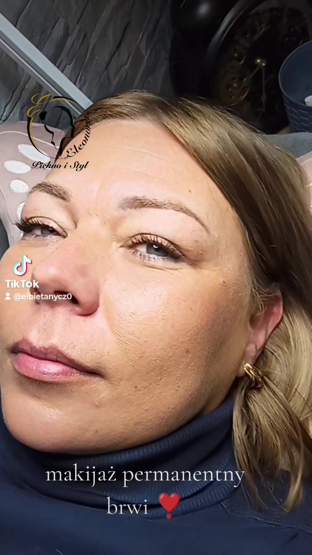 @elbietanycz0