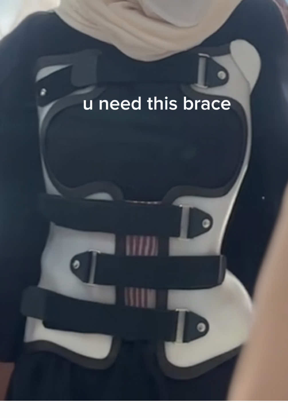 @SAM ORTHOTIC PROSTHETIC
