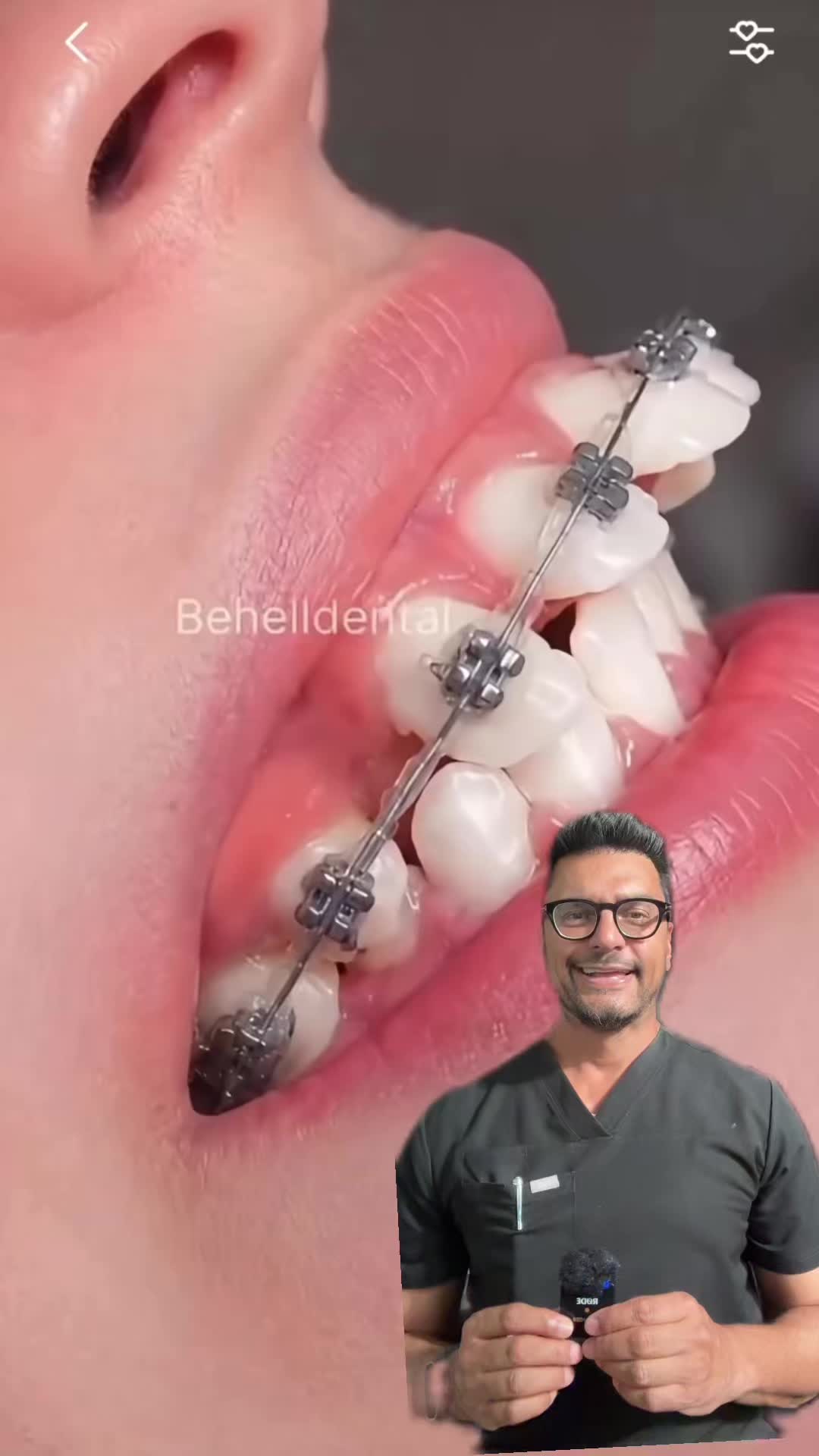 @Dentite