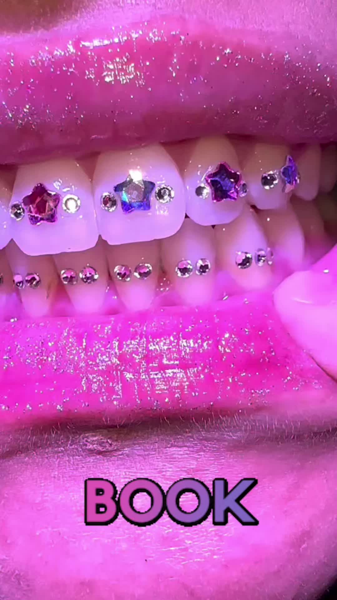 @Pretty Poisons tooth creations