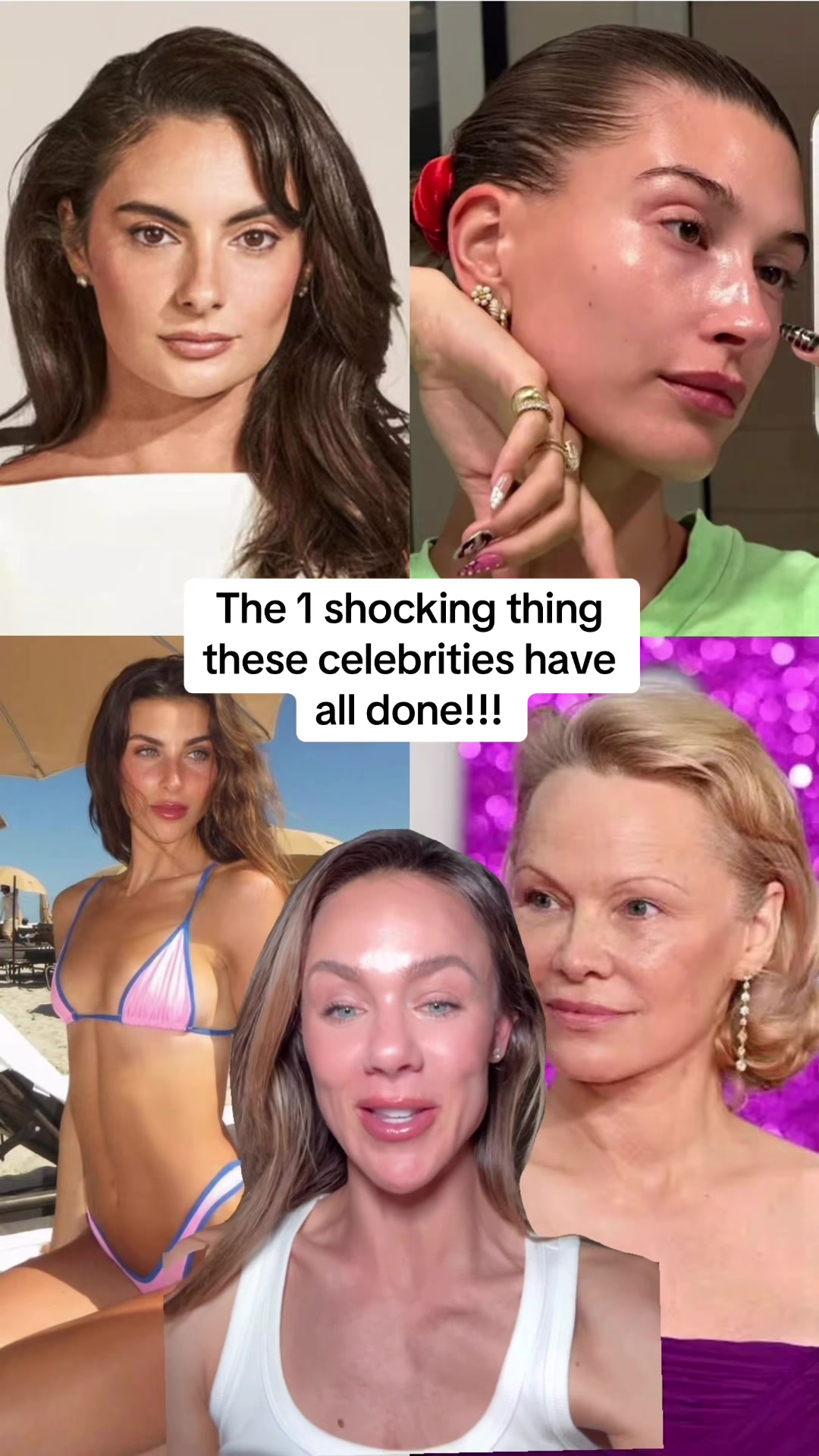 @Celeste | RN acne expert