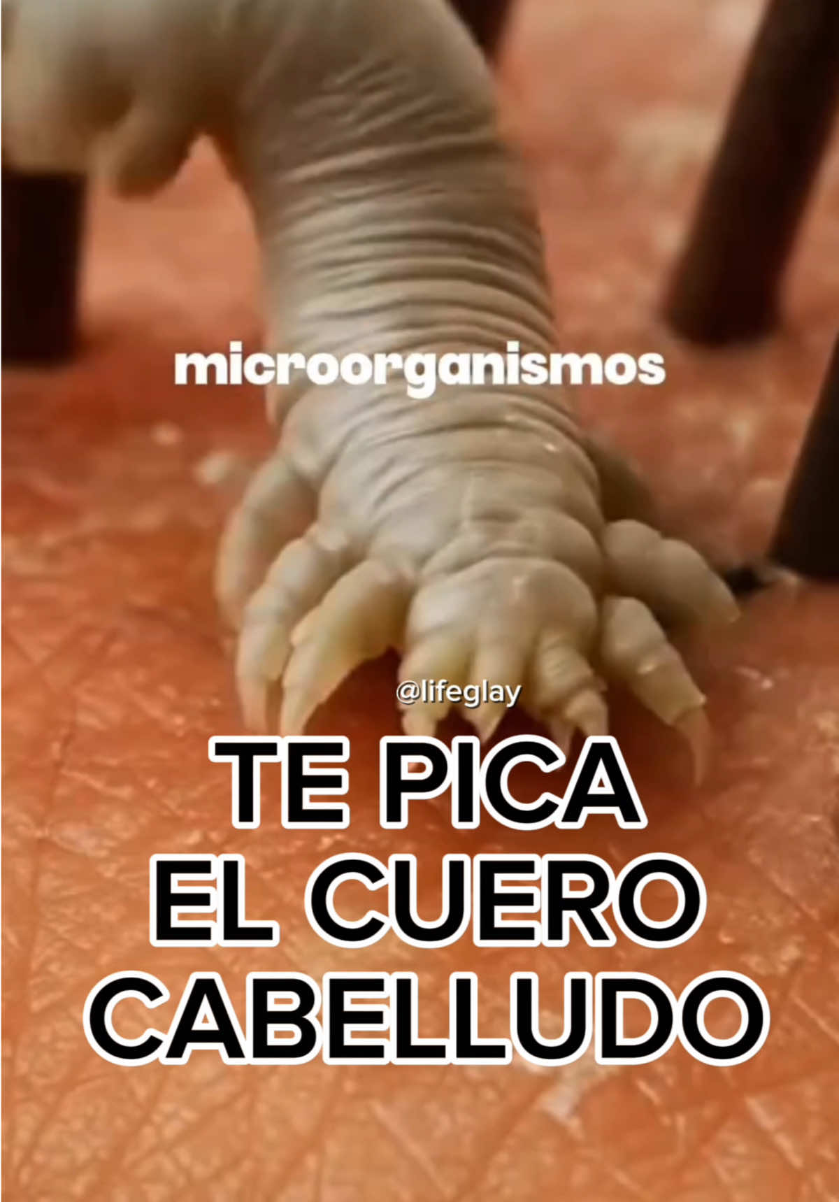 @lifeglay