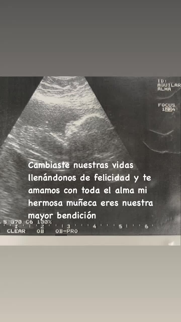@Alma Aguilar