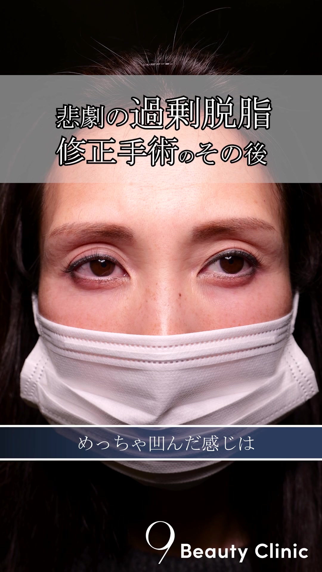 @りく先生　目元切開/クマ治療