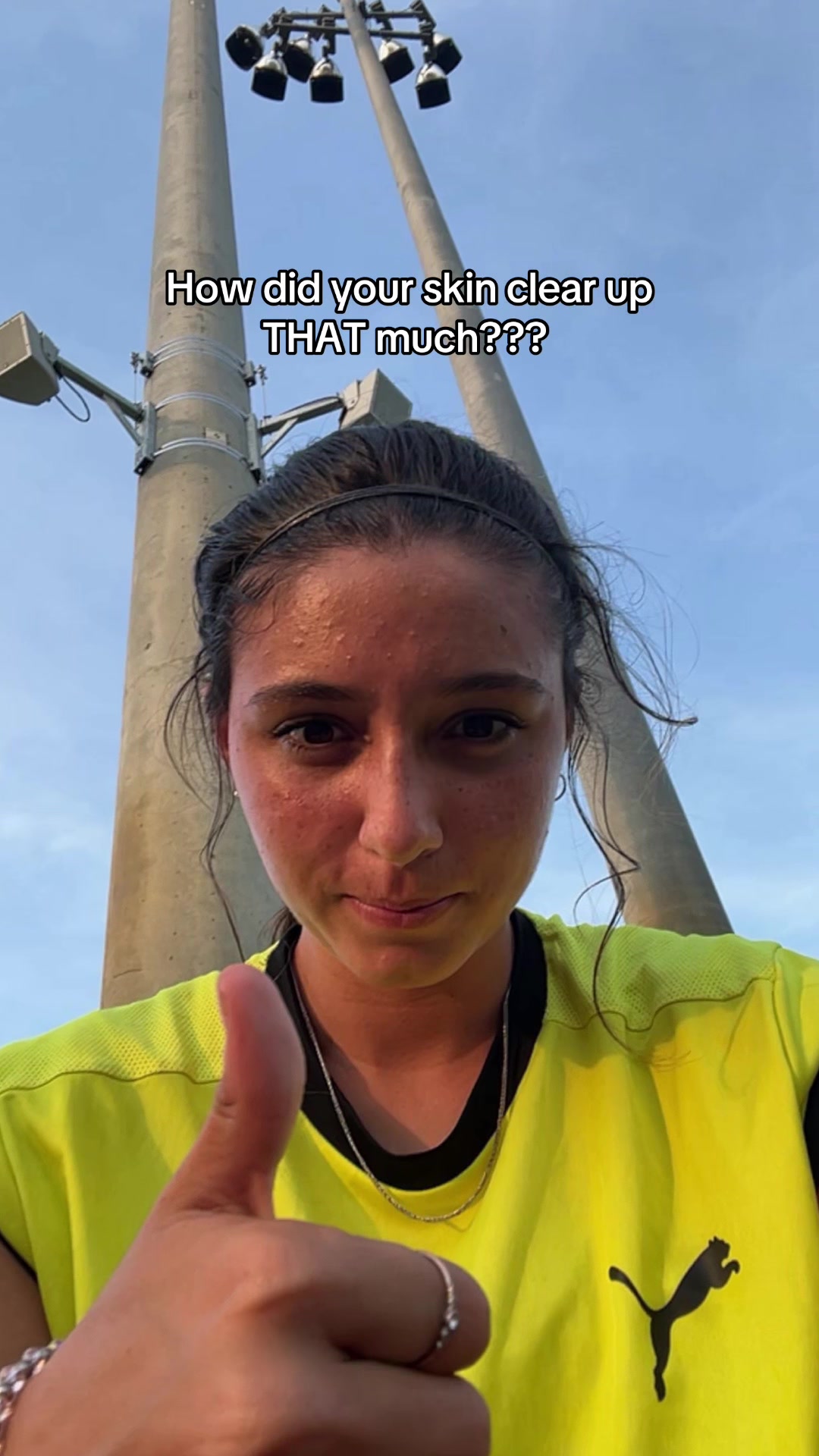 @Lily
