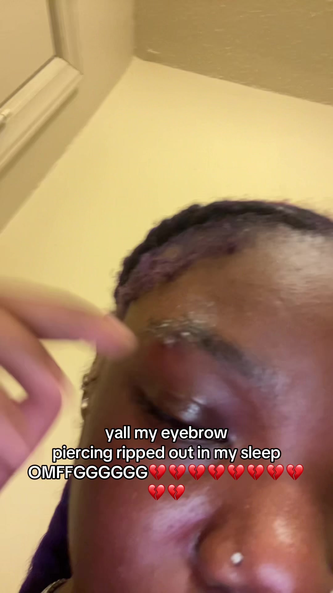 @666