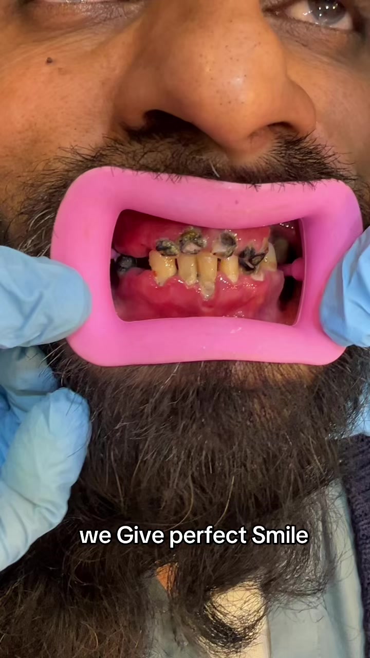 @Dr__Anmoll🦋🦷