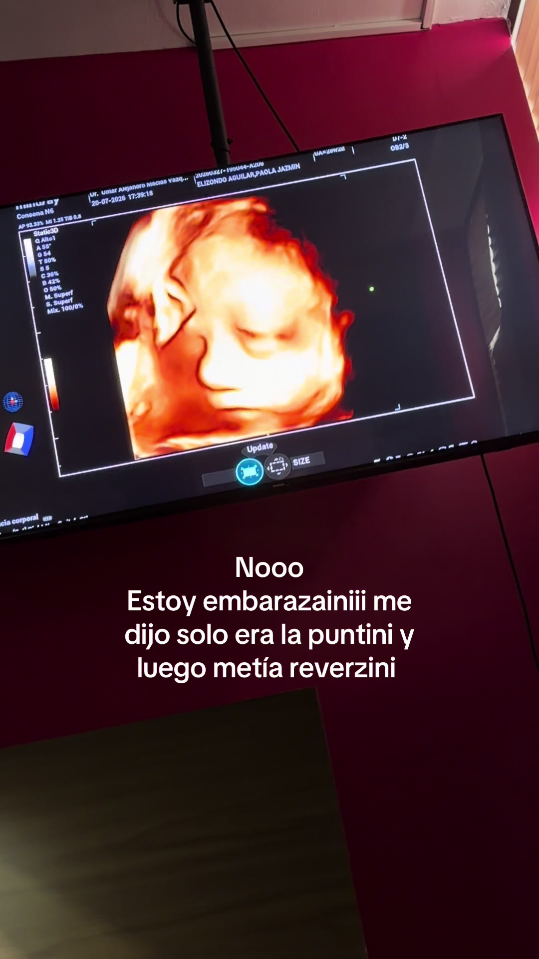 @Paola❤️🍒
