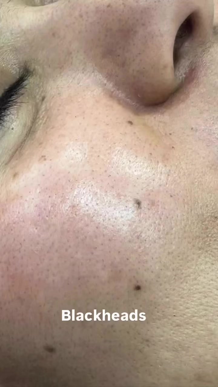 @NirmalKainth23