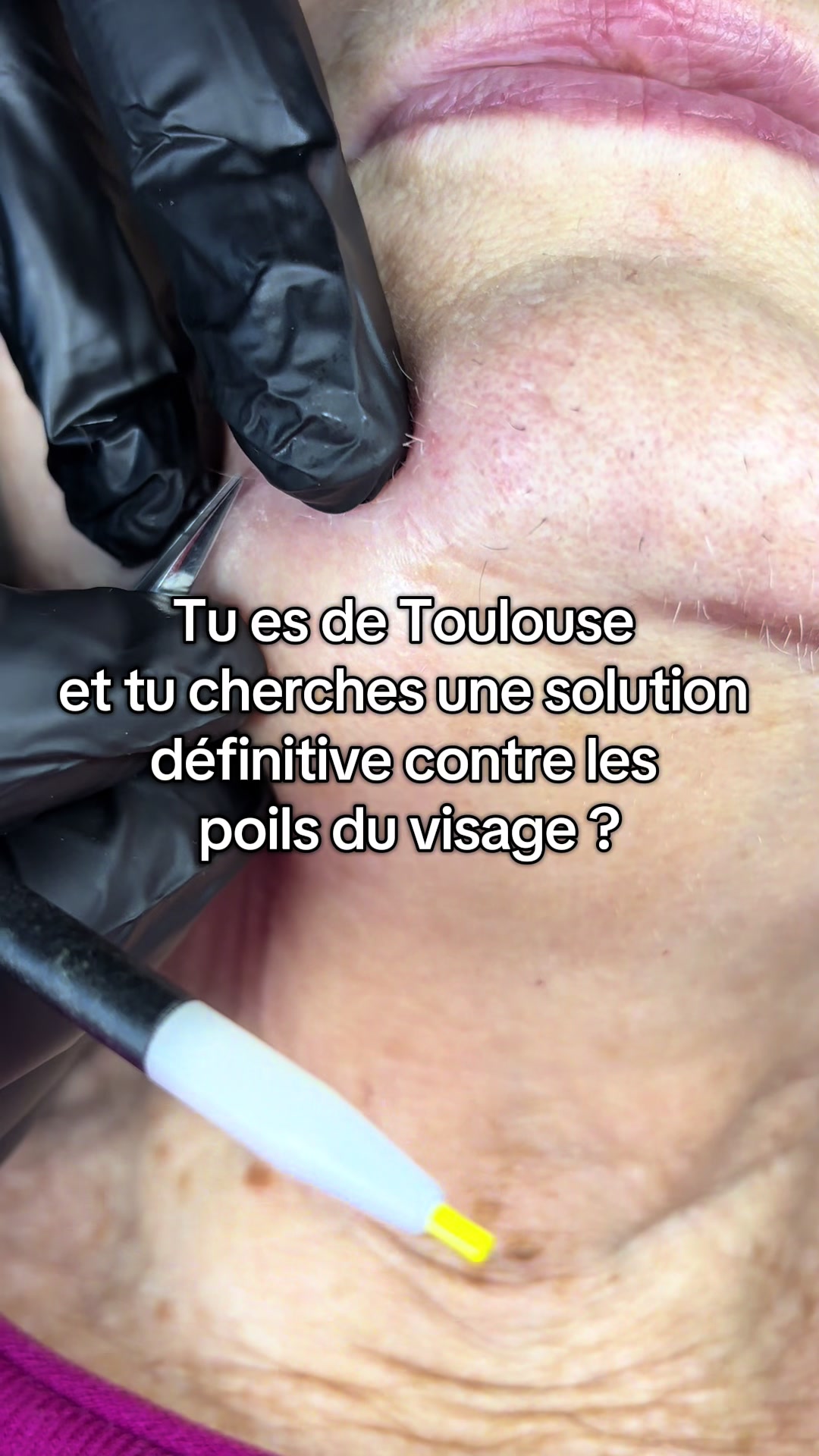 @SKINGLOW TOULOUSE