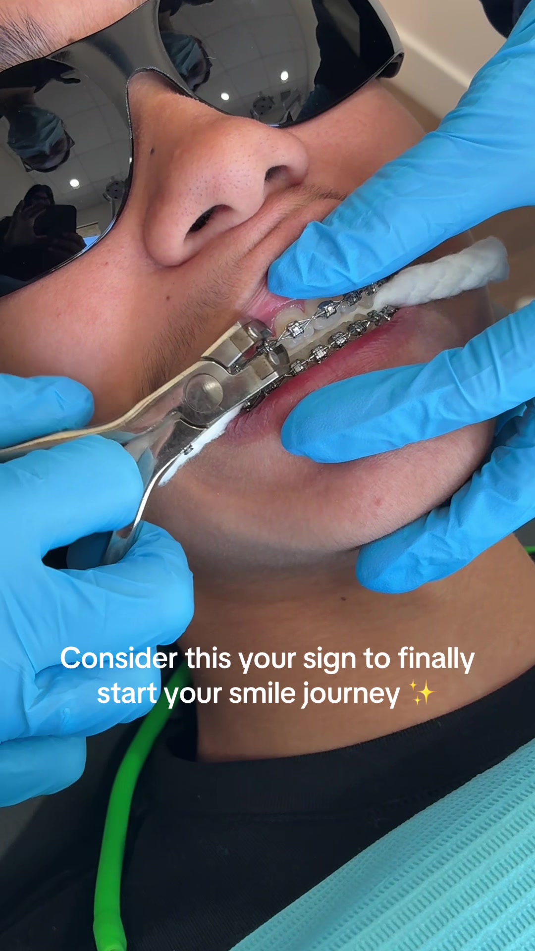 @Woodland Hills Orthodontist