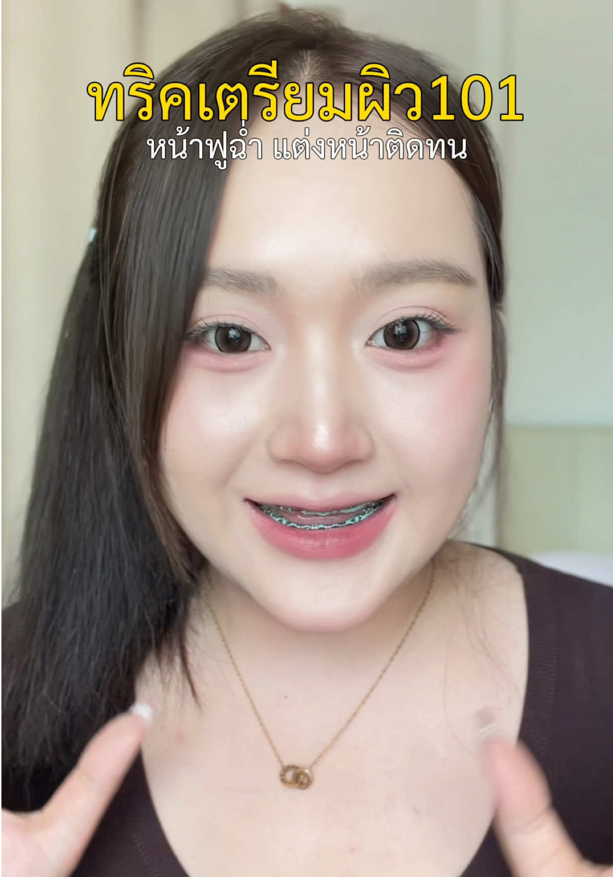 @เนมด่อง 🥳