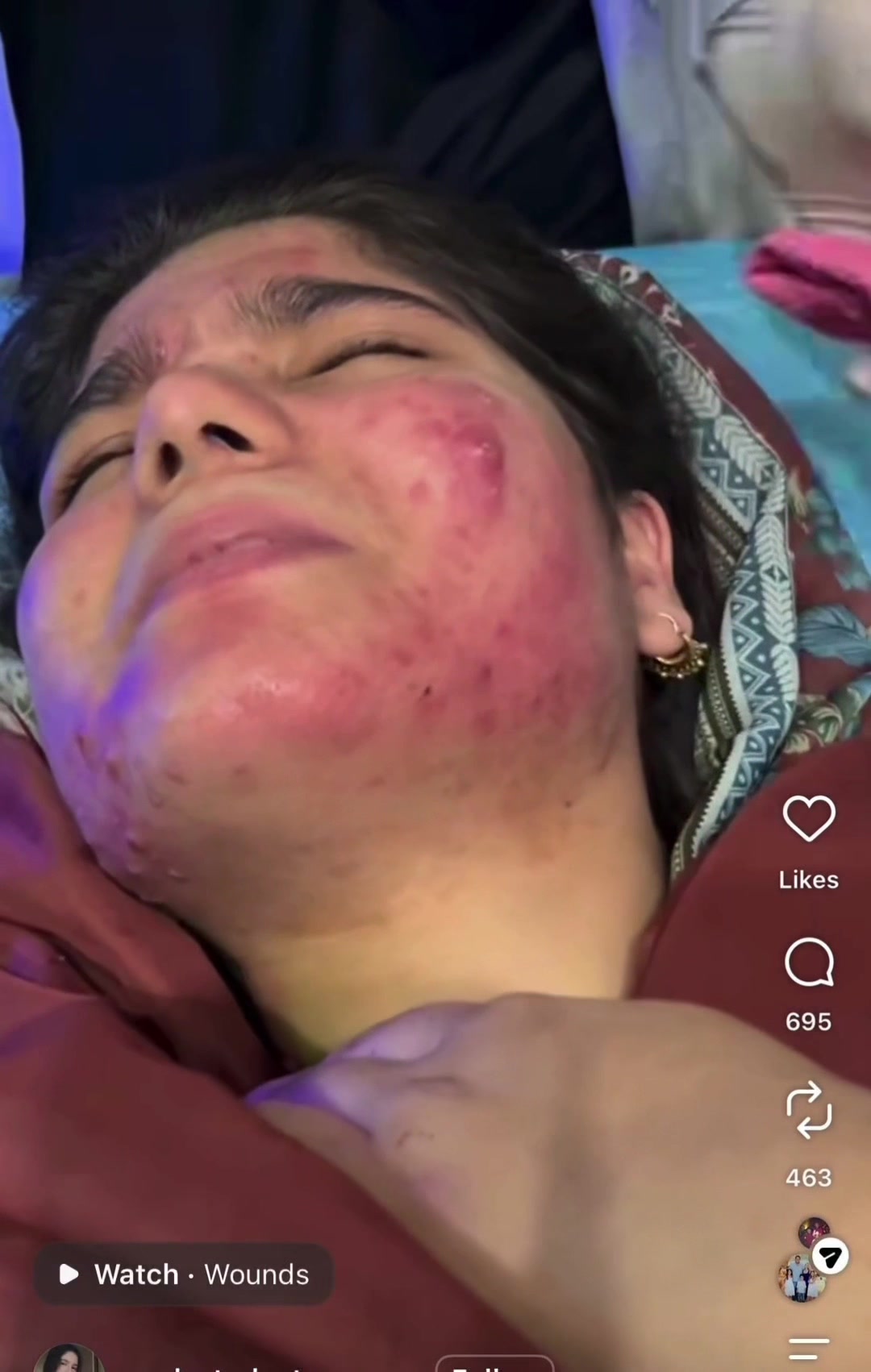 @Pure Skin OC