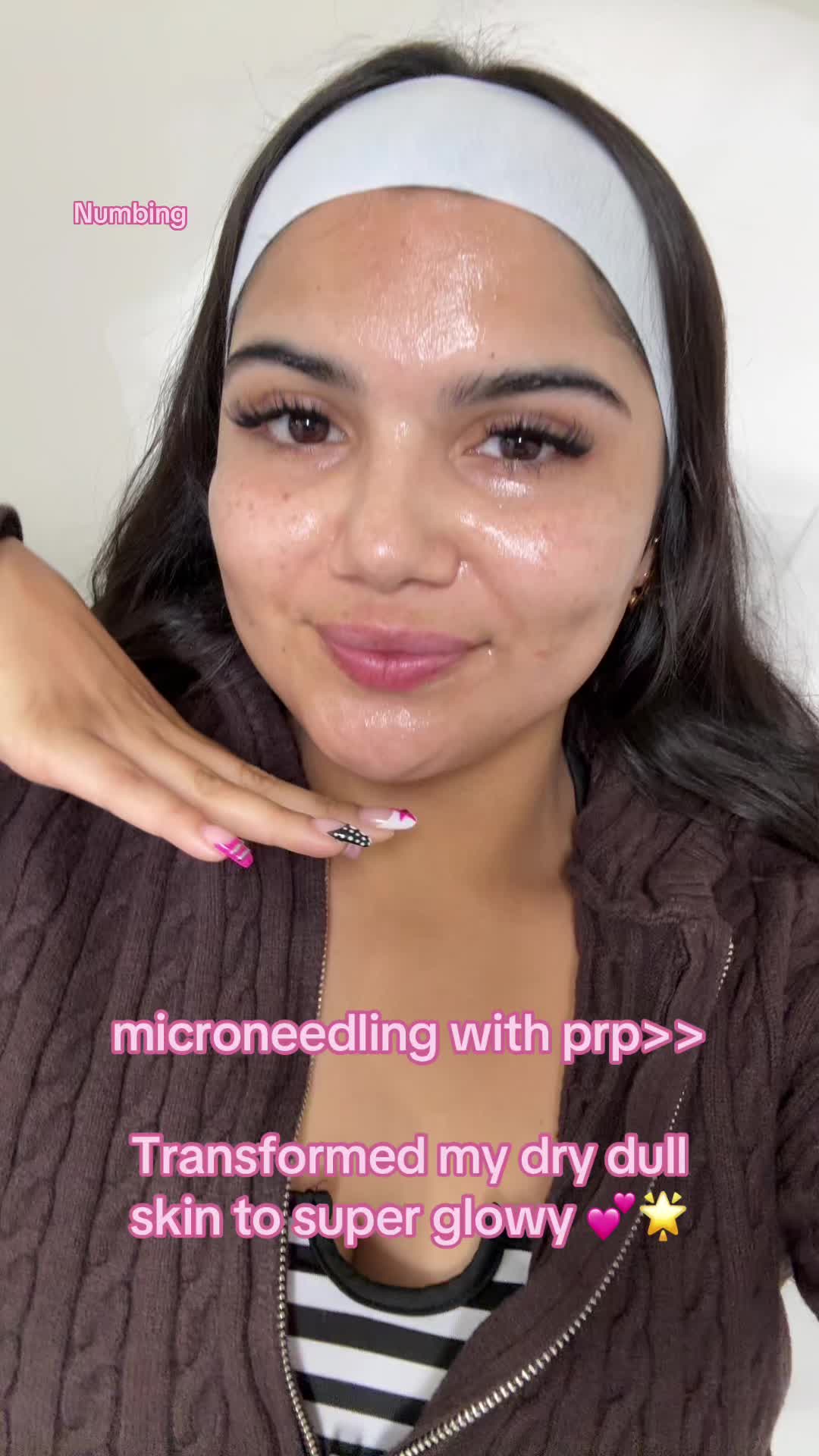 @Aowie