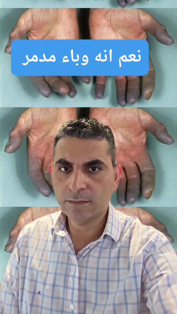 @Dr. Waleed Attia