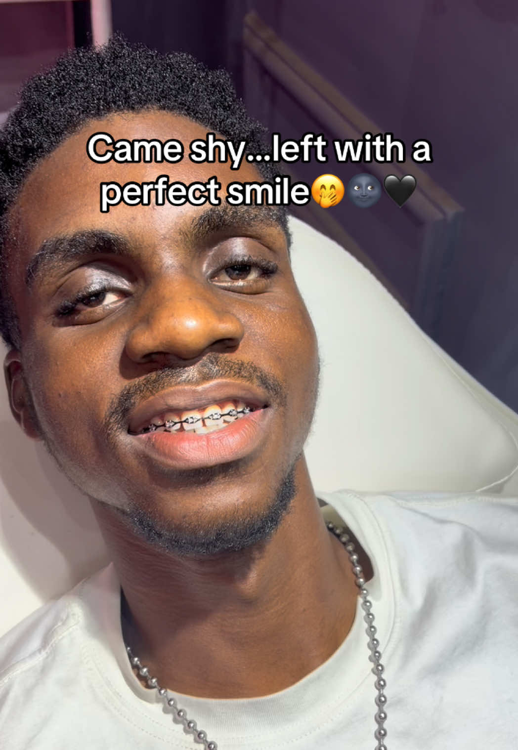 @Abuja Fashion Braces/Toothgems