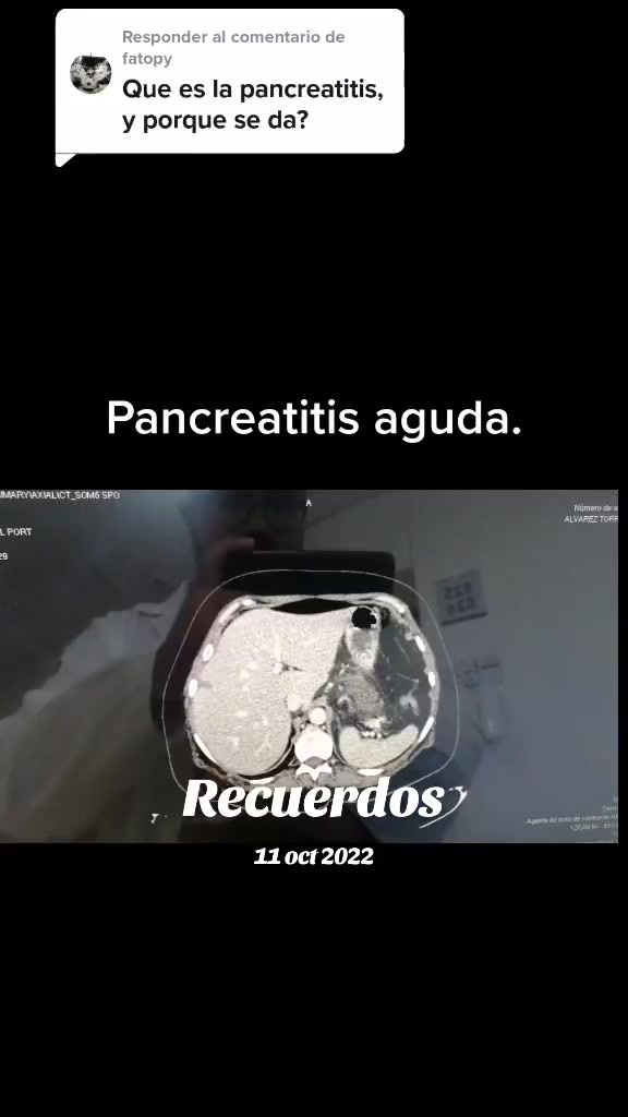 @Dr. Ajolote.