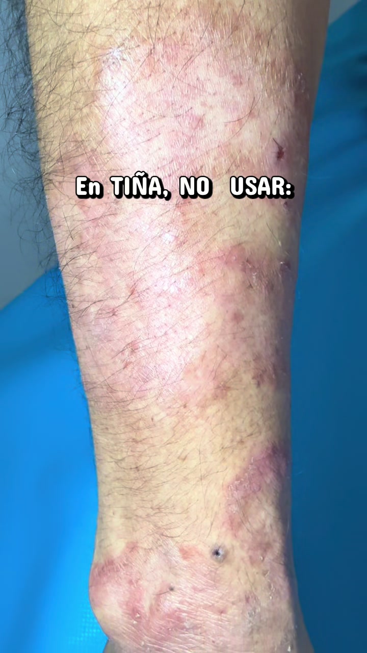 @dr.idrogodermatologo