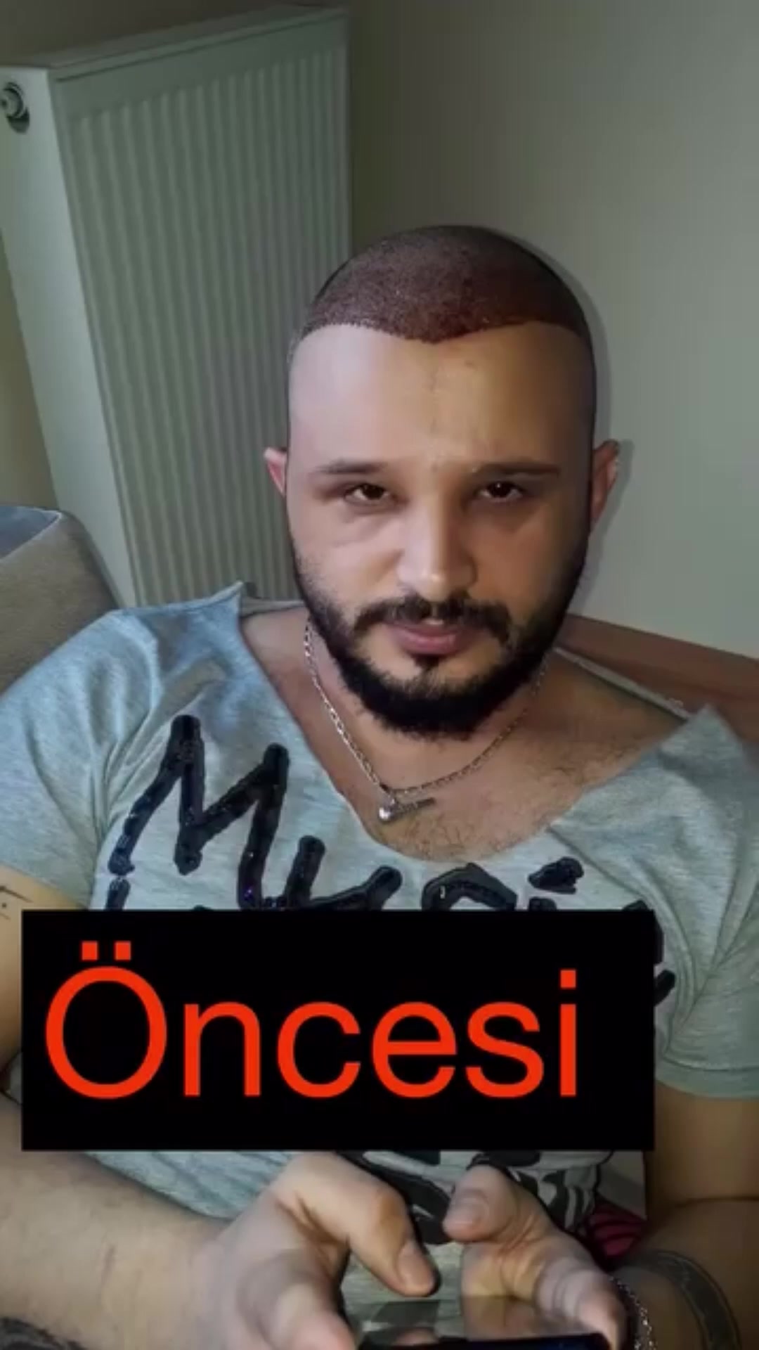 @Pau