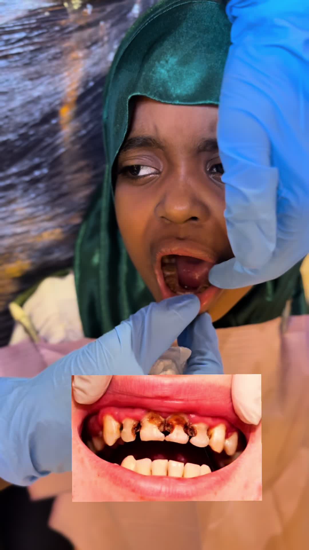 @DR.Mohani Said🇸🇴🦷🇲🇾