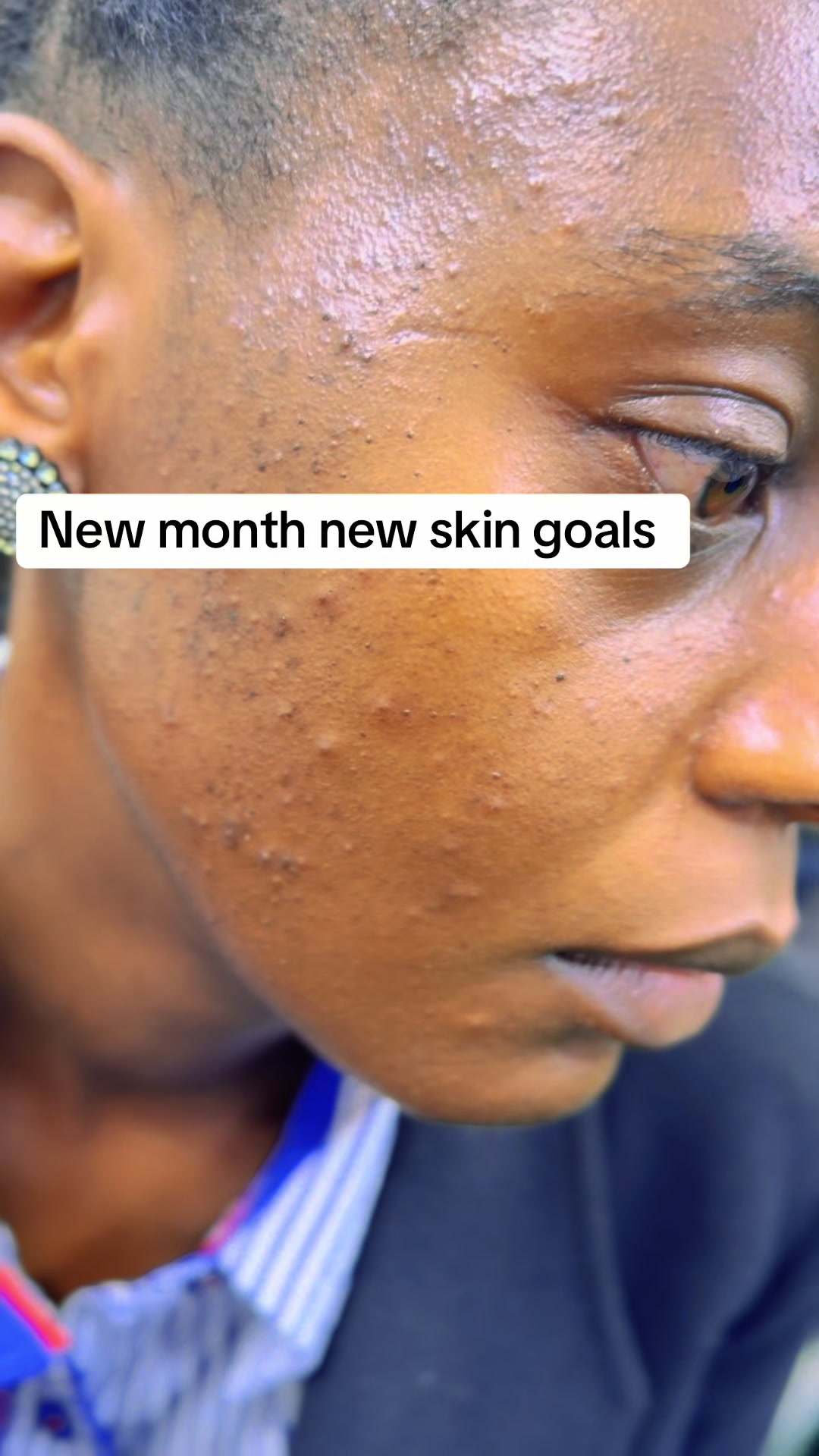 @CASIE SKINCARE & AESTHETIC SPA