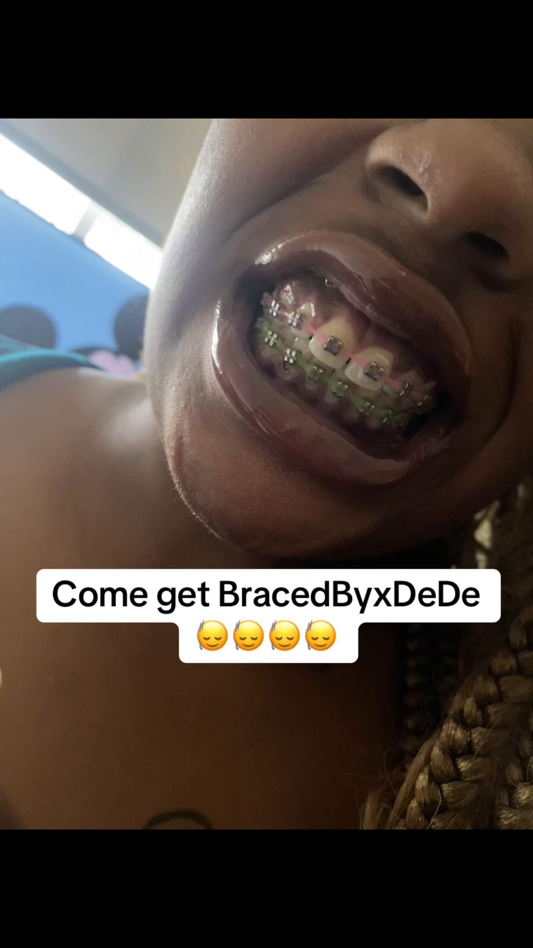 @xxdede21