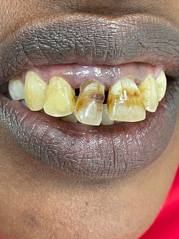 @Family Dental Clinic -Hargeisa