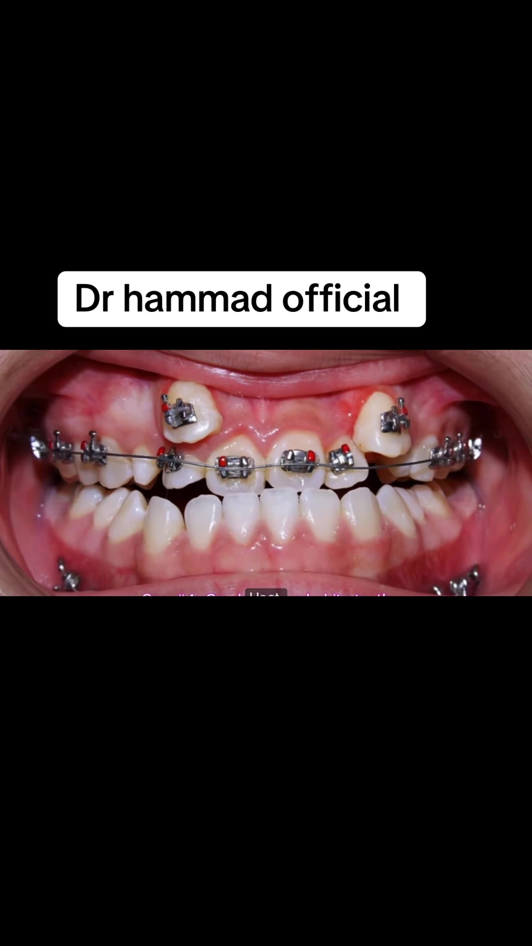 @🥀Dr_Hammad_official🥀