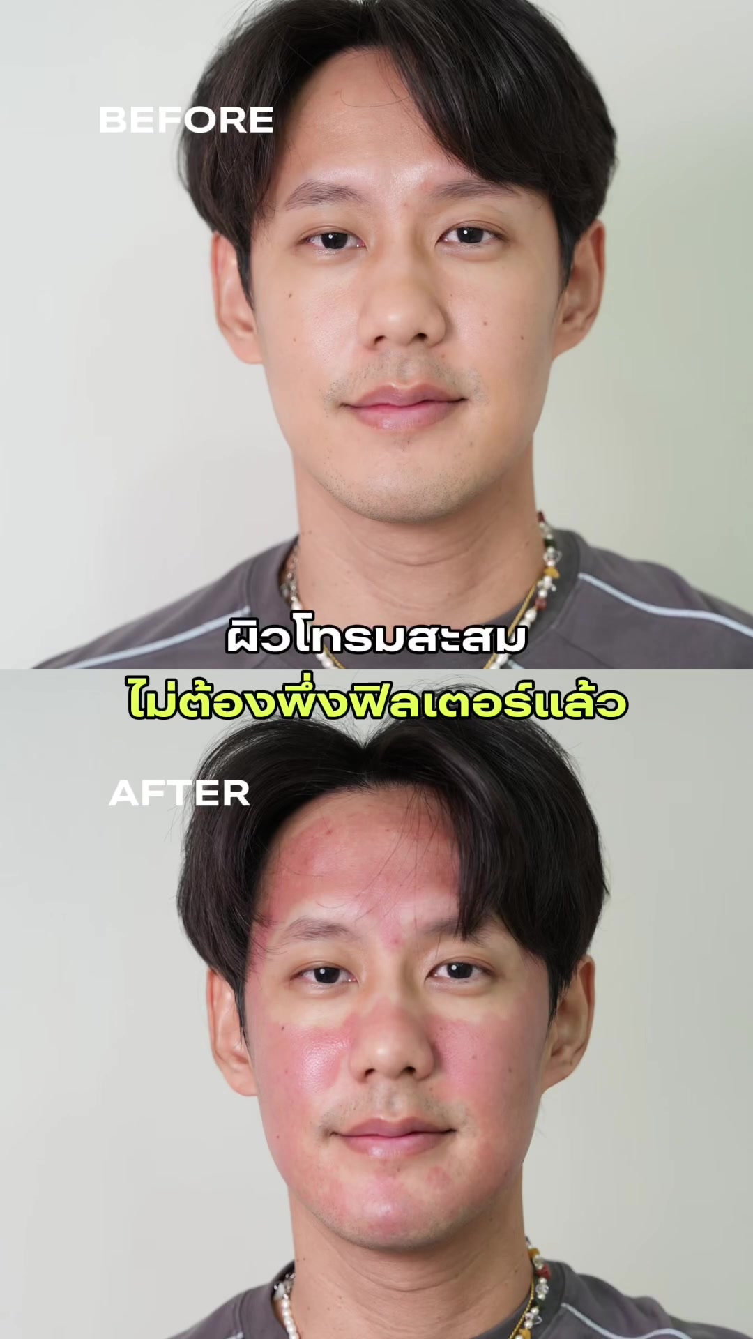 @Standard Skin clinic
