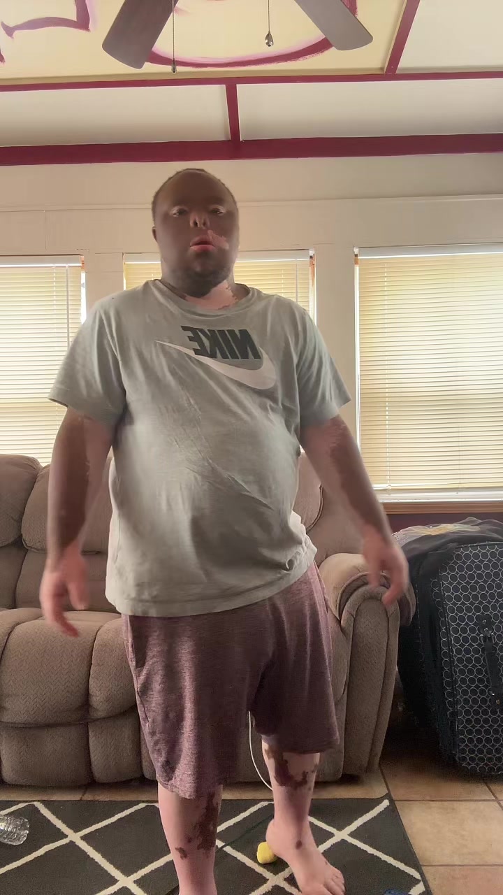 @Tre