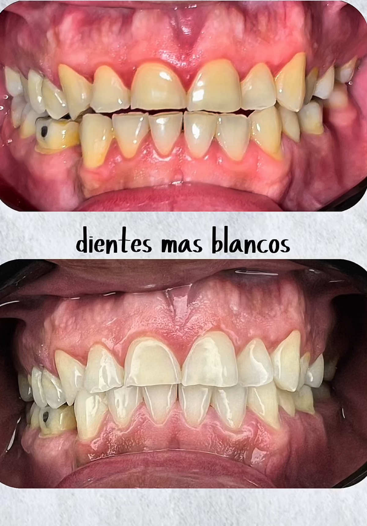 @pro.dental.od