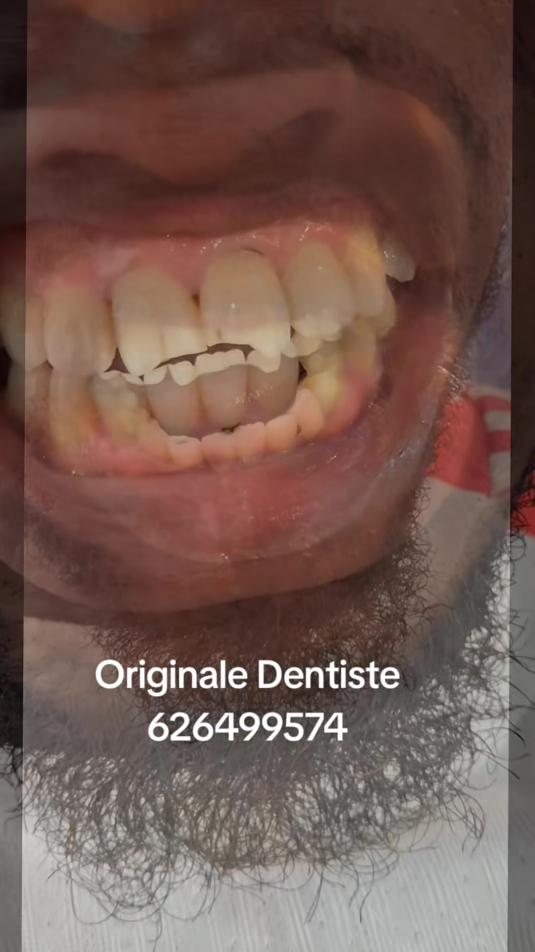 @Djoballa le dentiste