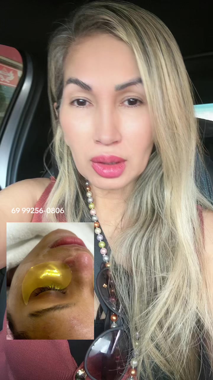 @Ana