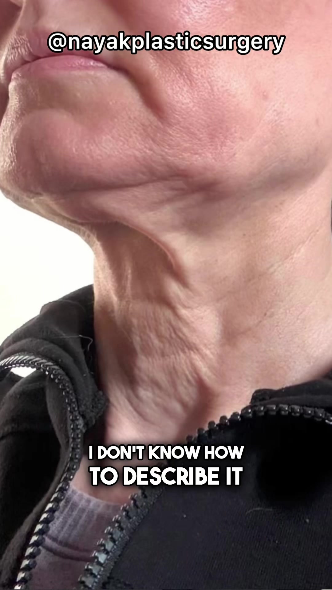 @NayakPlasticSurgery
